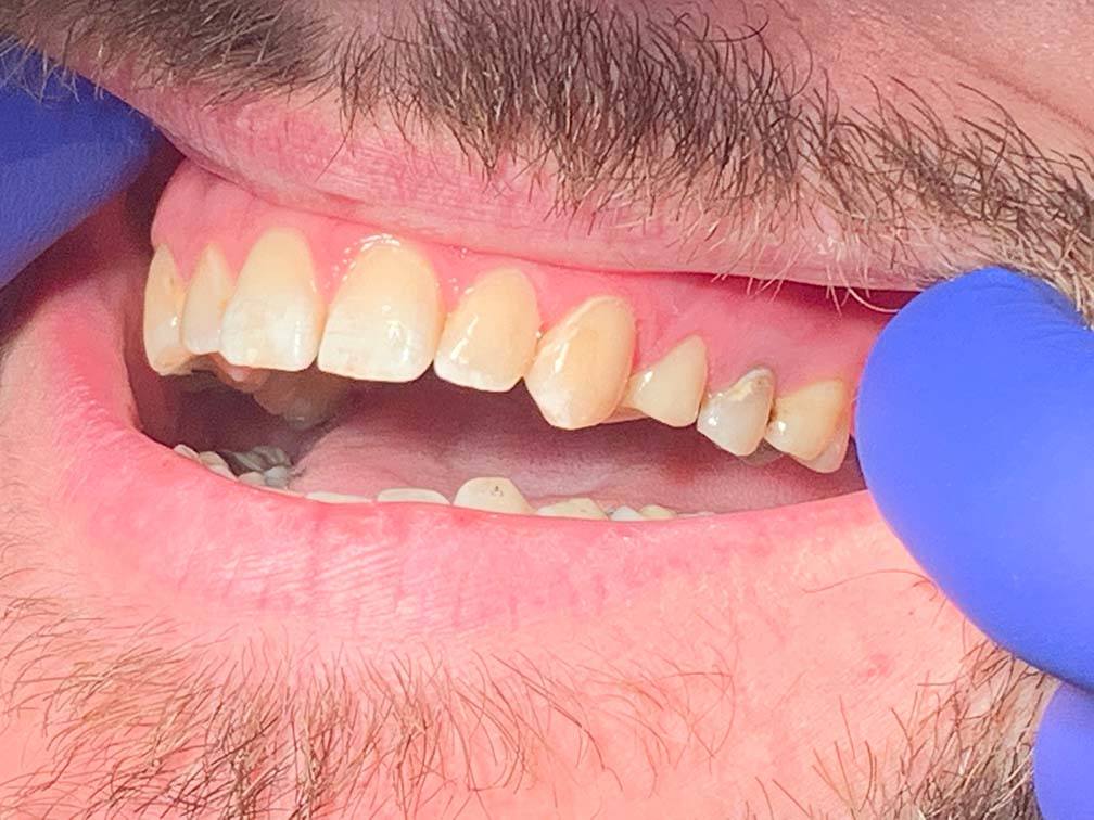 Perfected healthy smile after dental treatment