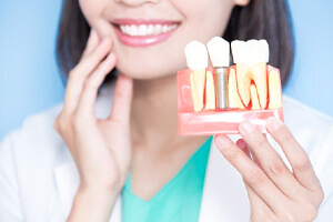 dentist showing a model of how dental implants work