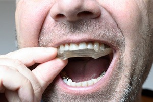 Man putting black mouthguard into his mouth before workout