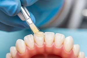 Fluoride being applied to teeth