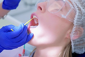 Dentist applying fluoride to a patient’s teeth