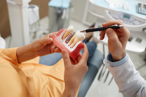 Dentist showing patient a model of a dental implant